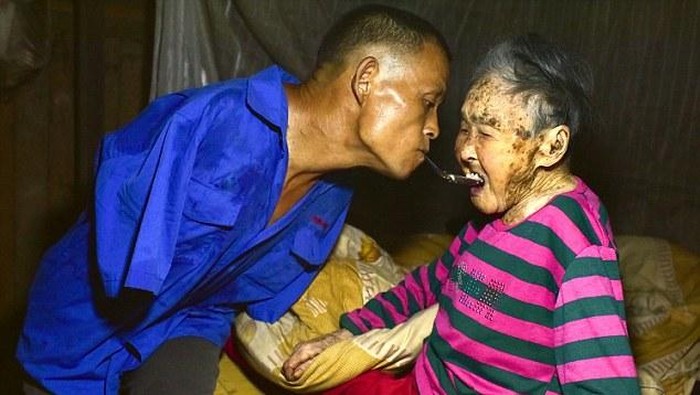 Tak Punya Tangan, Pria Ini Tetap Semangat Mengurus Ibunya yang Lumpuh
