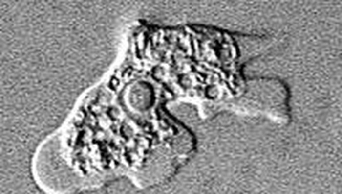 Naegleria Fowleri alias amoeba pemakan otak.