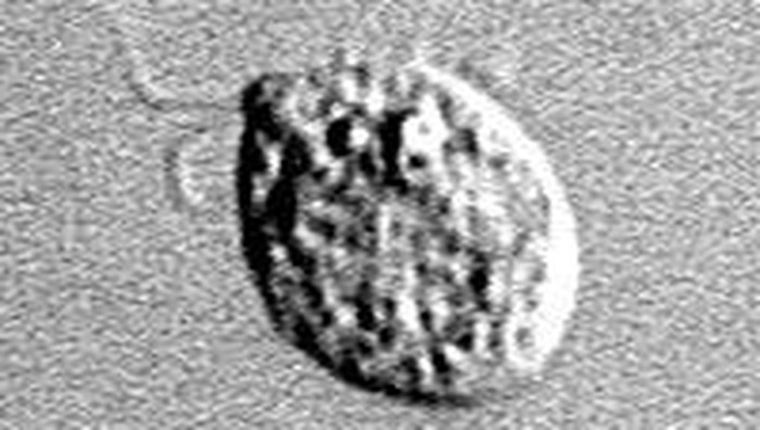 Naegleria Fowleri alias amoeba pemakan otak.