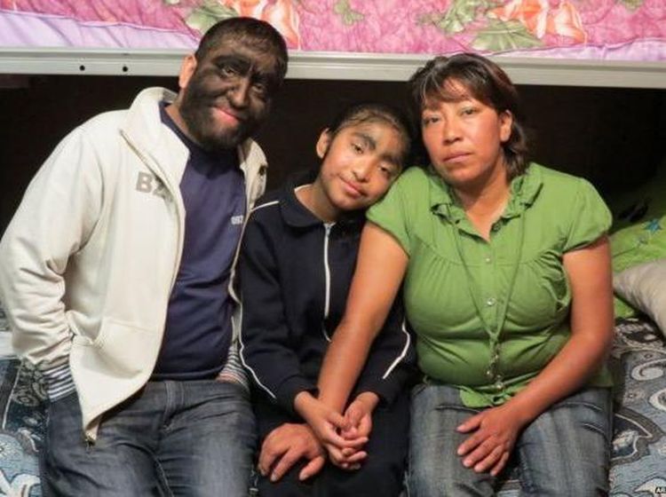 Potret Keluarga Serigala, Mutasi Buat Rambut Sekeluarga Tumbuh Liar