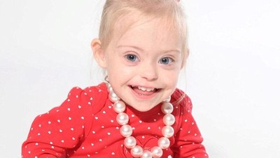 Potret Connie-Rose, Bocah 2 Tahun dengan Down Syndrome yang Sukses Jadi Model