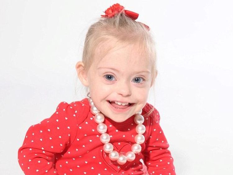 Potret Connie-Rose, Bocah 2 Tahun dengan Down Syndrome yang Sukses Jadi Model