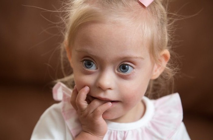 Idap Down Syndrome Tak Halangi Langkah Bocah 2 Tahun Ini Jadi Model