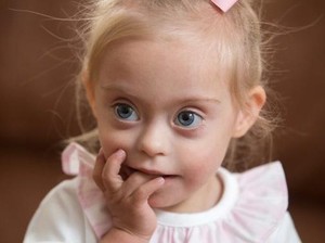 Idap Down Syndrome Tak Halangi Langkah Bocah 2 Tahun Ini Jadi Model