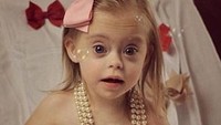 Meskipun sudah saya jelaskan bahwa putri saya mengidap Down Syndrome, pihak agen mengungkapkan hal tersebut tak masalah. Tentu ini hal yang positif baginya, ungkap Julie berseri-seri. (Foto: Daily Mail)
