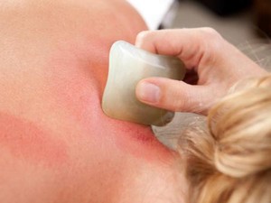 Kata Dokter Soal Kerokan di Leher pada Pasien Hipertensi