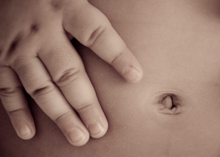 Apakah Pusar Bodong Perlu Dioperasi?