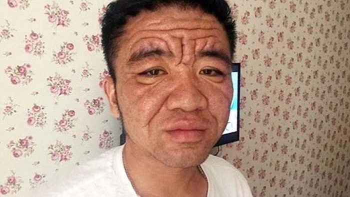 Masih 30 Tahun Tapi Wajah Seperti Kakek-kakek karena Kondisi Misterius