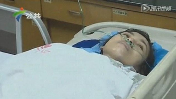 Terselamatkan dari Sambaran Petir Berkat Kawat di Bra