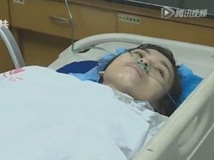 Terselamatkan dari Sambaran Petir Berkat Kawat di Bra