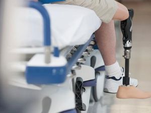 Terluka Saat Mencukur Bulu Kaki, Kaki Wanita Ini Diamputasi