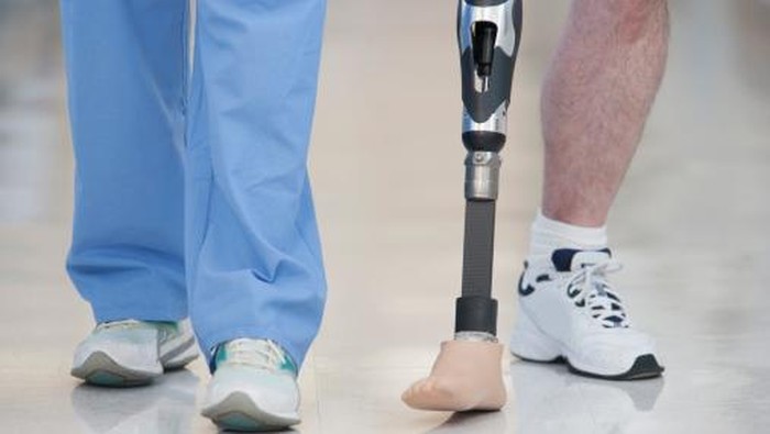 Akibat Diabetes Tak Terkontrol, Pria Ini Harus Kehilangan Kaki