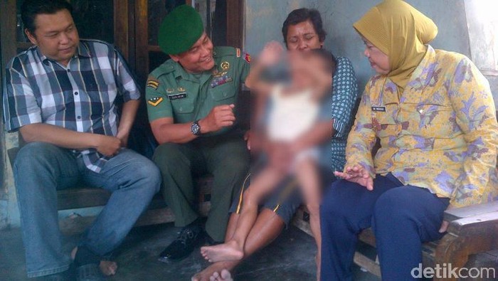 Bocah 5 Tahun di Semarang yang Kecanduan Rokok Menderita Bronkitis
