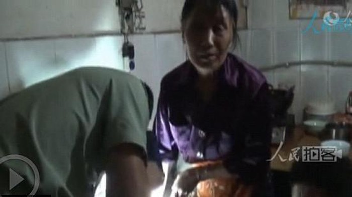 Meski Tangan Terjebak di Gilingan Daging, Wanita Ini Tetap Tenang