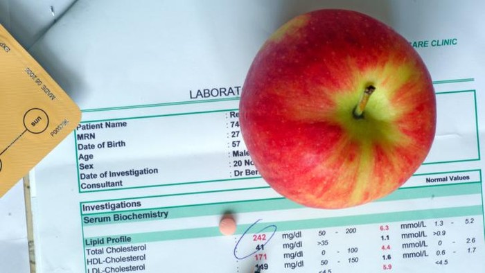 Hasil tes kolesterol, dengan apel dan obat.