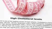 Kadar kolesterol selalu terjaga dan tidak pernah melonjak tinggi merupakan ciri selanjutnya. (Foto: ilustrasi/Thinkstock)