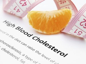 Kenali Pola Makan yang Bikin Kolesterol Tinggi