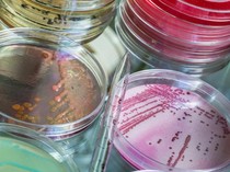 Ilmuwan Temukan Lebih dari 1.000 Bakteri dan Mikroba Baru di Tanah Amerika