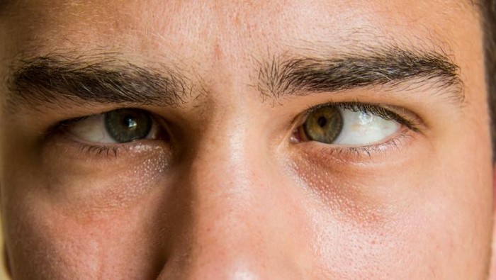 Keinginan besar di bawah malah bikin mata jadi rusak. (Foto: thinkstock) Keinginan besar di bawah malah bikin mata jadi rusak. (Foto: thinkstock)