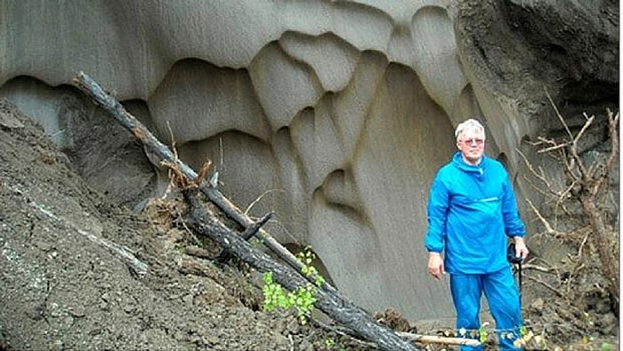 Ilmuwan Ini Bereksperimen Suntikkan Bakteri Jutaan Tahun ke Tubuh Sendiri