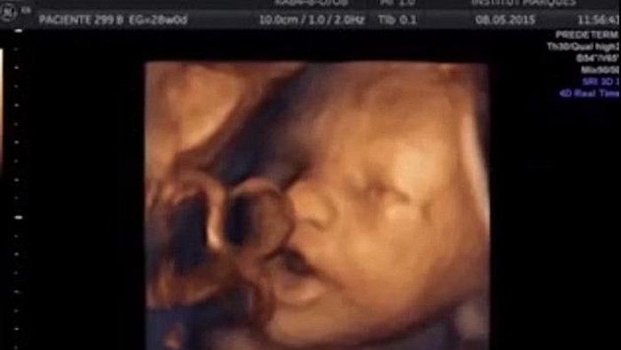 Seperti Bernyanyi, Begini Cara Janin Merespons Suara dari Luar