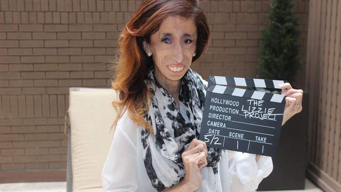 Pernah Disebut Perempuan Paling Jelek, Lizzie Velasquez Melawan Bullying