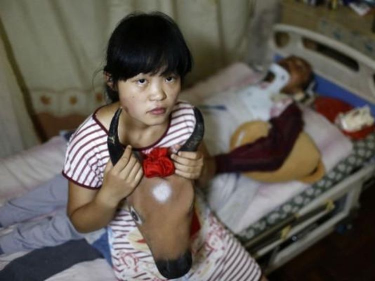 Potret Remaja yang Rela Pura-pura Jadi Sapi Demi Biaya Berobat Ayahnya