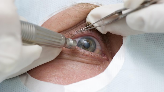 Kecelakaan Saat Tur Bikin Mata Lauren Juling Atas-bawah