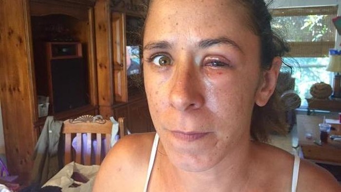 Minta Tetes Mata Dikasih Lem Super, Kelopak Mata Katherine Menempel