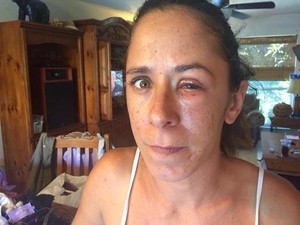 Minta Tetes Mata Dikasih Lem Super, Kelopak Mata Katherine Menempel