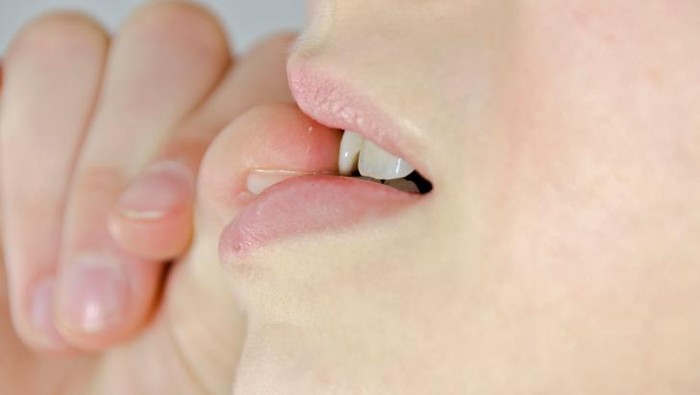 Senam Mulut Bisa Bantu Atasi Gangguan-gangguan Seperti Ini