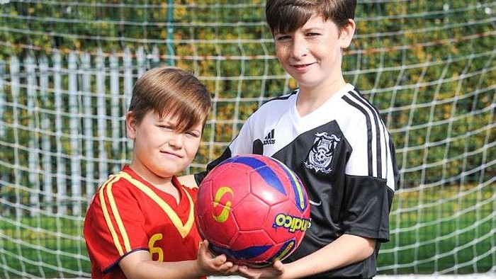 Idap Sindrom Langka, Kakak Adik Penyuka Sepakbola Ini Tak Punya Jari Kaki