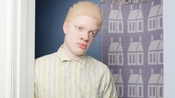 Melihat sosok model Amerika yang terlahir albino, Angelina dAuguste terinspirasi membuat galeri foto yang memperlihatkan keindahan dan keunikan orang albino.