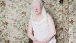 Melihat sosok model Amerika yang terlahir albino, Angelina dAuguste terinspirasi membuat galeri foto yang memperlihatkan keindahan dan keunikan orang albino.