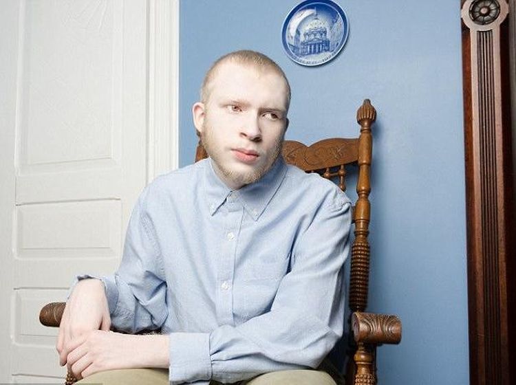 Potret Albino yang Juga Bisa Cantik dengan Cara Mereka Sendiri