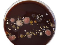 Ini 2 Jenis Bakteri Kebal Antibiotik yang Diungkap Kemenkes