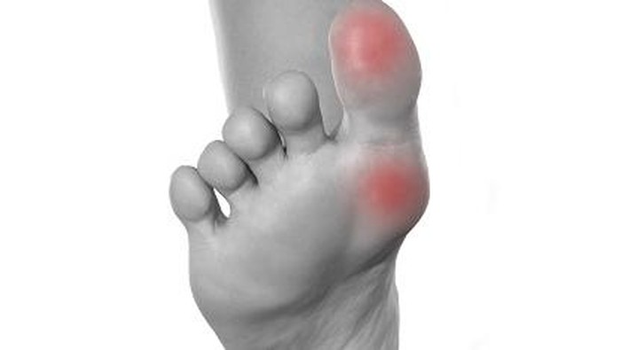Aching feet after whole day