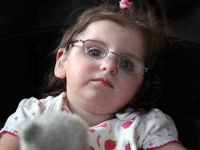 Kena Sindrom Langka, Bocah Ini Diprediksi Takkan Sempat Tumbuh Dewasa