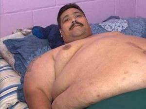 Terungkap! Ini Penyebab Kematian Manusia Tergemuk di Dunia