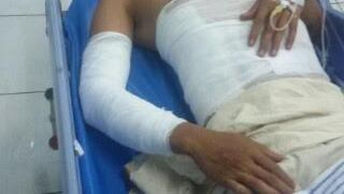 Pria ini Hendak Bakar Rusun Tapi Justru Terbakar Sendiri