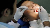 Apakah Tambal Gigi Ditanggung BPJS Kesehatan?