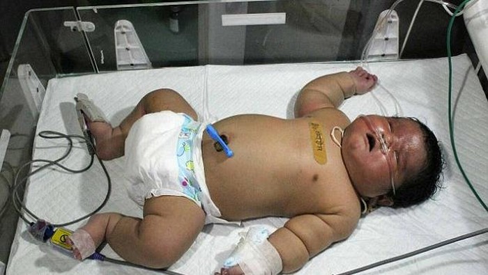 Rekor Baru Bayi Terbesar di India: Bobot 7 Kg dan Lahir dalam 15 Menit