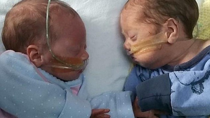 Dua Bayi Mungil yang Prematur ini Dihangatkan dalam Kantong Plastik