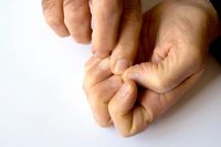 Memotong kuku secara rutin.