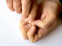 Tak Melulu Nyeri Dada, Dokter Ungkap Gejala Sakit Jantung yang Muncul di Jari