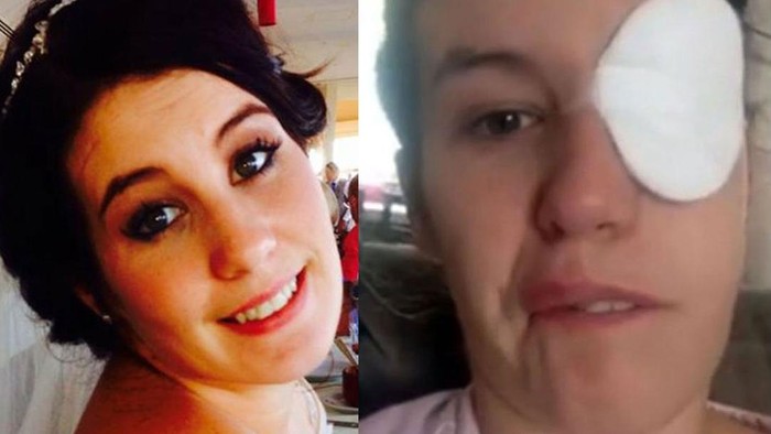 Mirip Stroke, Wajah Wanita Ini Terus-terusan Lumpuh karena Kondisi Langka