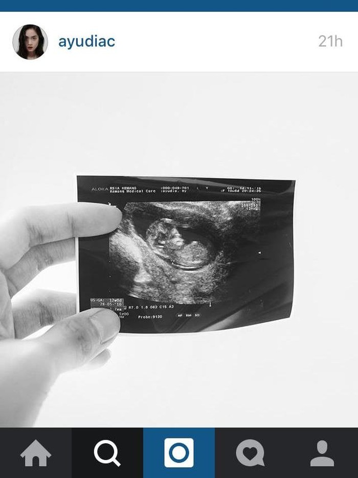 Ayudia Bing Slamet Hamil Anak Pertama