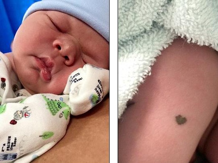 Unik! Bayi Laki-laki Ini Punya Tanda Lahir Berbentuk Hati di Kaki