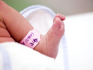 Kisah Bayi Kembar Siam di India, Beda Kelamin dan Berbagi Organ Serta Kaki