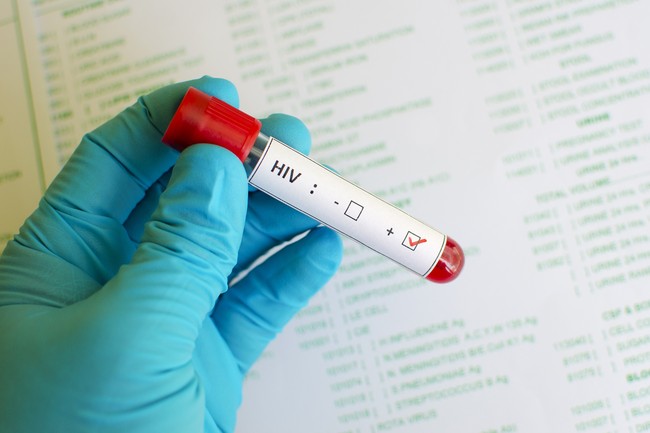 5 Kabar Penularan HIV-AIDS yang Ternyata Hoax